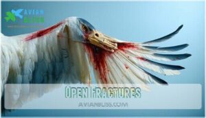 open fractures